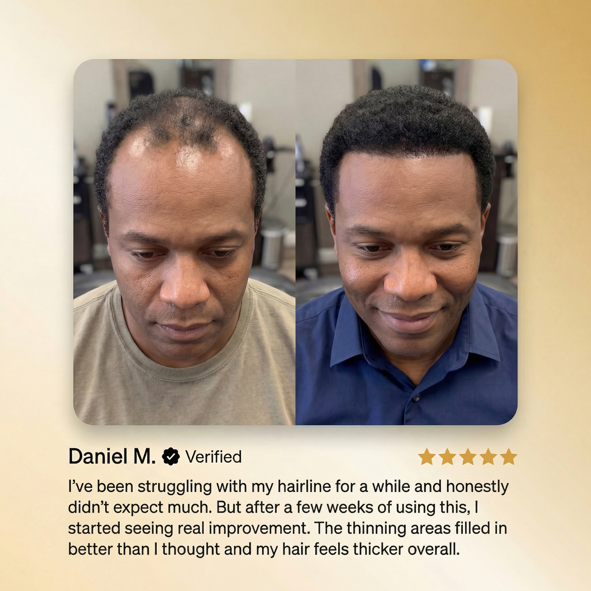 🔥 ADVANCED HAIR REGROWTH BATANA OIL — JUST $49.99 🔥